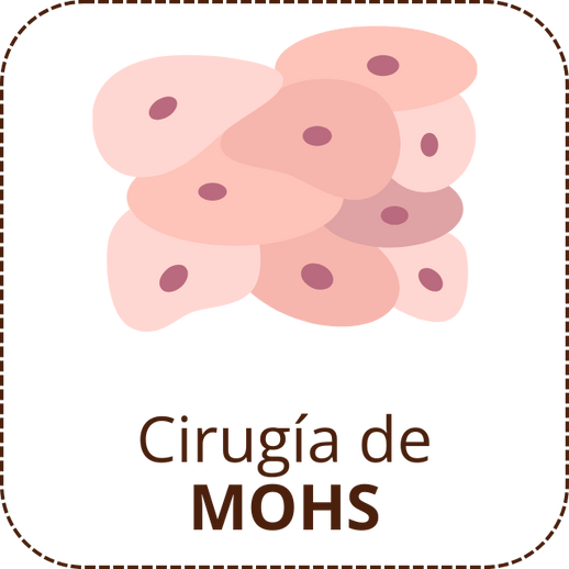 Cirugía de MOHS (1)