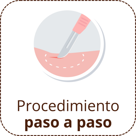 Cirugía de MOHS (2)